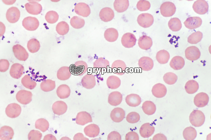 Septicémie dans sang x400 - gryphea.com